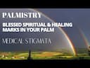 Unlocking Healing Secrets: Understanding Medical Stigmata in Palmistry -DKSCORE Unlocking Healing Secrets: Understanding Medical Stigmata in Palmistry -DKSCORE